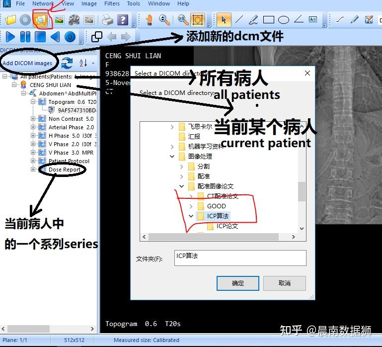 dcm文件怎么打开首先,点击左上角的文件夹图标,或者"add dicom images