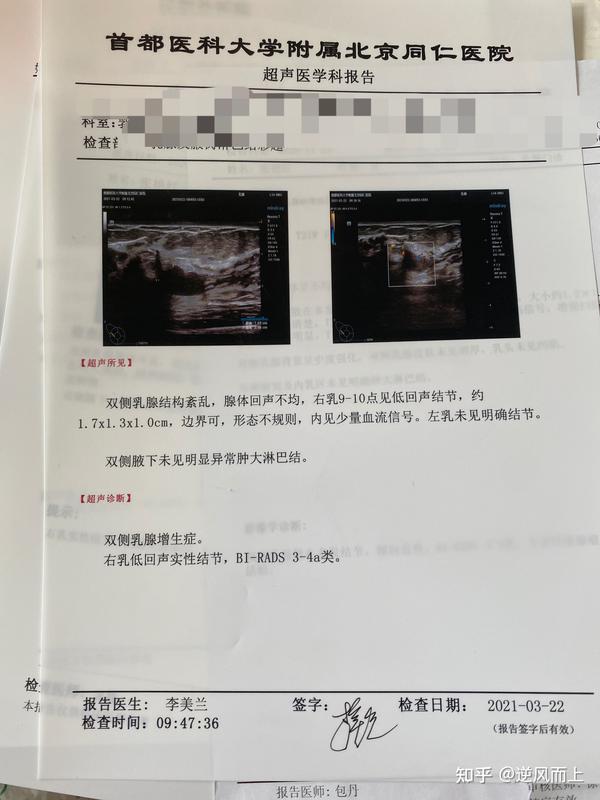 乳腺彩超结节4a不规则崩溃了造影也检查了