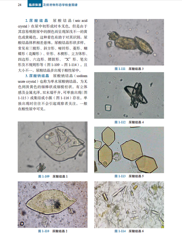 临床体液及排泄物形态学检查图谱第2版典型形态学图片助你练就火眼金