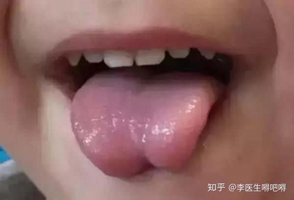 伊能静,脑袋和舌头上都有个坑