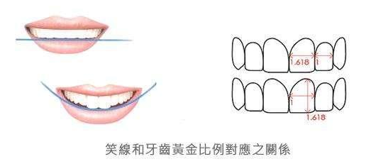 切端的连接构成笑线,应与下唇上缘平行,中心部分自然向下弯曲,牙齿和