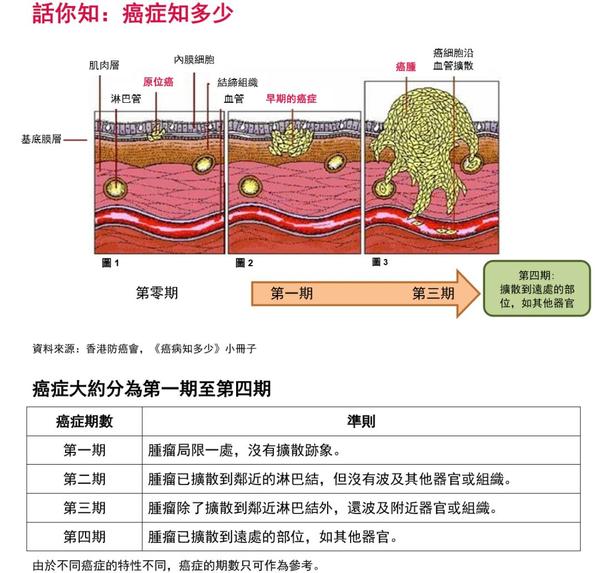 原位癌:指有恶性细胞,但恶性细胞局限于上皮内尚未突破 基底膜,浸润