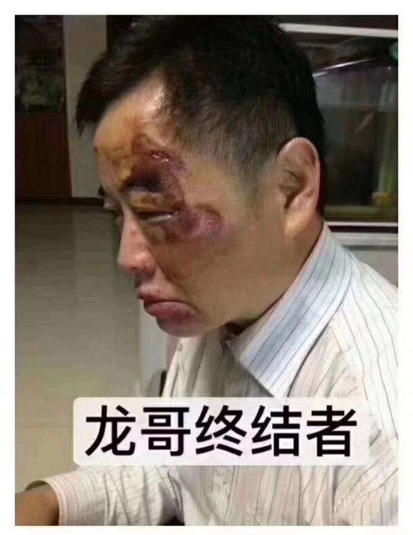 昆山龙哥砍人事件,龙哥临死之际,内心会想些什么,会后悔吗?