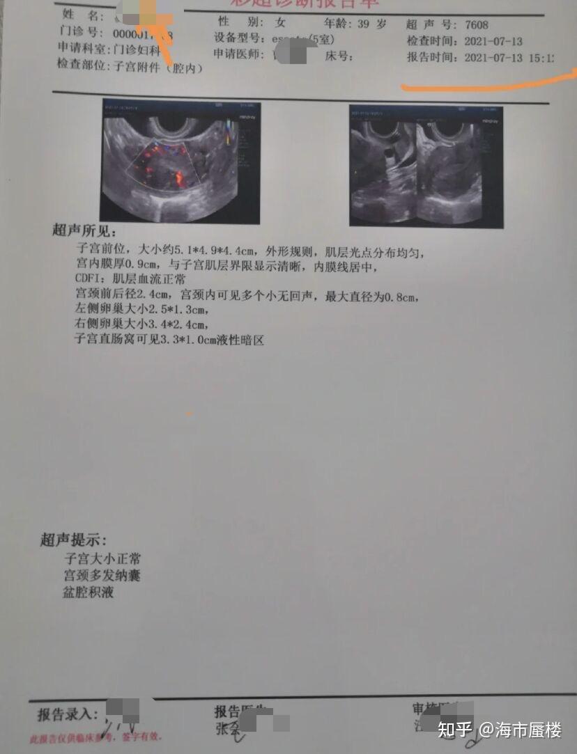 我被子宫腺肌症折磨好多年求医路上虽然艰难但是终于好了