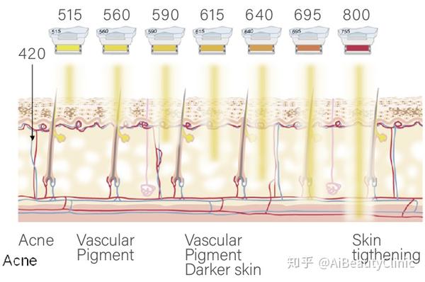 光子嫩肤英文怎么说