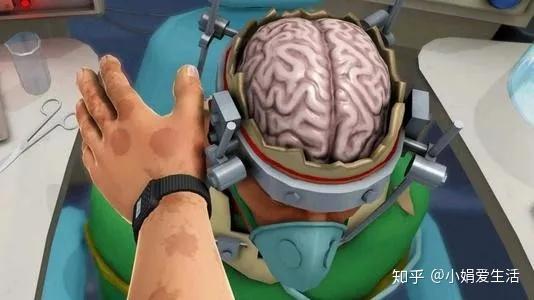 良性脑肿瘤,微创开颅手术,外力引起的脑损伤.重疾