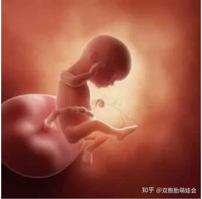 b超孕16周的双胞胎胎儿影像图