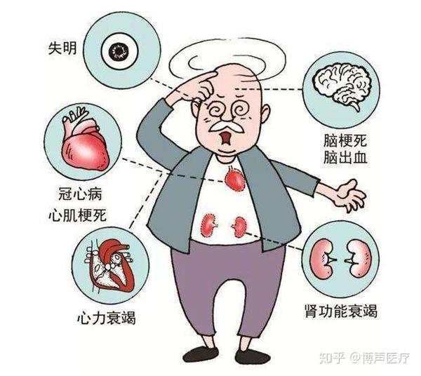 高血压性心脏病的临床表现