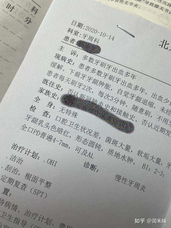 北大口腔第一门诊部牙周刮治详细记录内含医生推荐