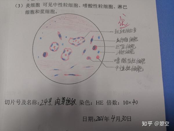 24号  肉芽组织切片(大家伙将就着看吧)