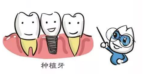 种植牙能用多久种植牙术前术后应注意的几件事
