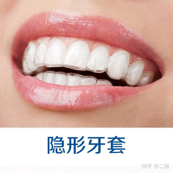 五,舌侧矫治器 舌侧矫治器是把钢牙套或者陶瓷牙套装在牙齿舌侧面