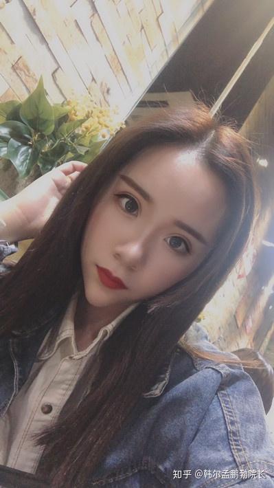 术后30天;双眼皮恢复的很自然,一双大眼睛自然又灵动.