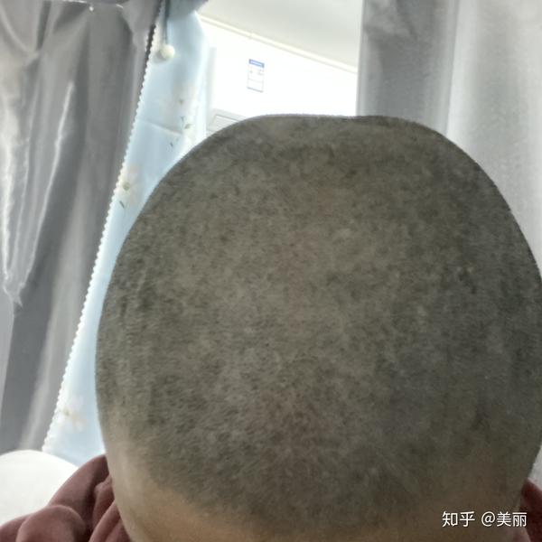 女生剃光头是种什么体验