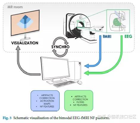 Eeg Fmri