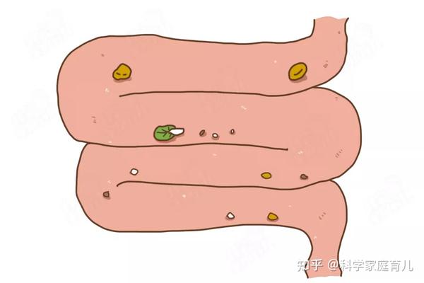 吃香蕉不通便越吃越堵这些水果才是便秘克星