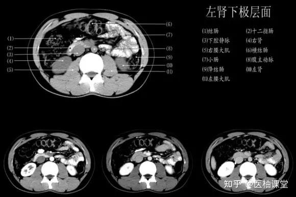 腹腔干层面肝右叶下级层面双肾动脉层面脾门上部层