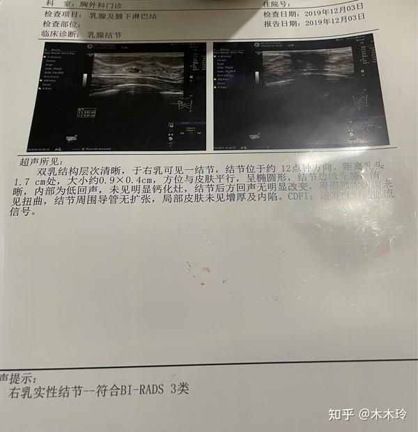 乳腺结节3级变小