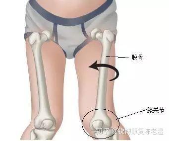 膝盖受伤后如何锻炼恢复臀肌平衡?