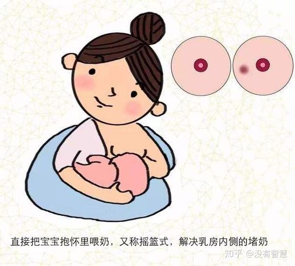 堵奶如何处理?