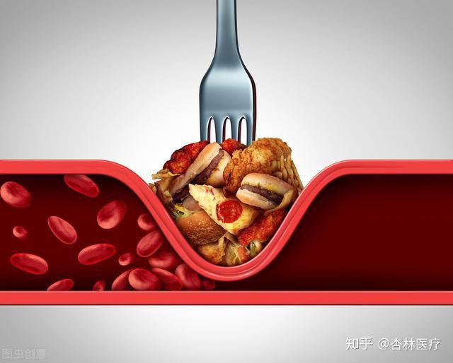 研究发现从正常食物所摄取的胆固醇对血胆固醇的影响其实有限,与心