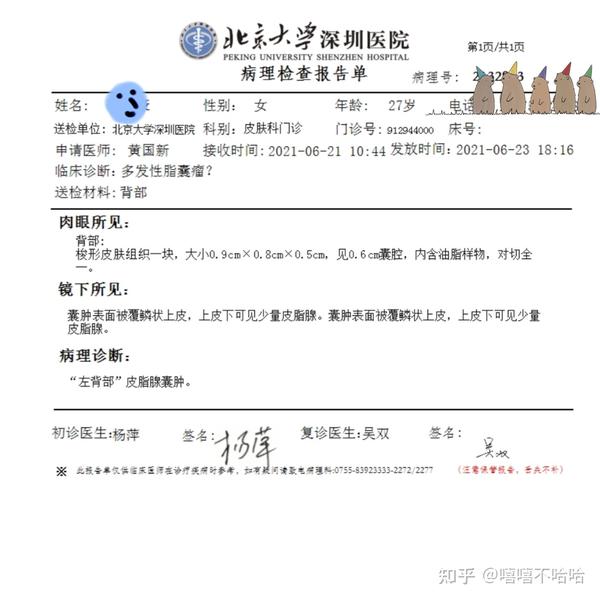 多发性脂囊瘤皮脂腺囊肿病例记录0704更新