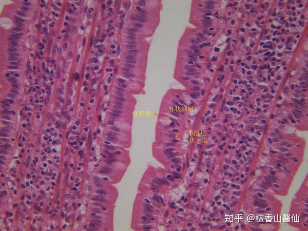 小肠黏膜上皮为单层柱状,由吸收细胞,杯状细胞及少量内分泌细胞组成.