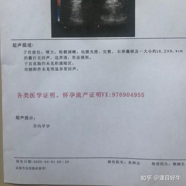 怎么分辨真假 怀孕 b超单,一招就可以