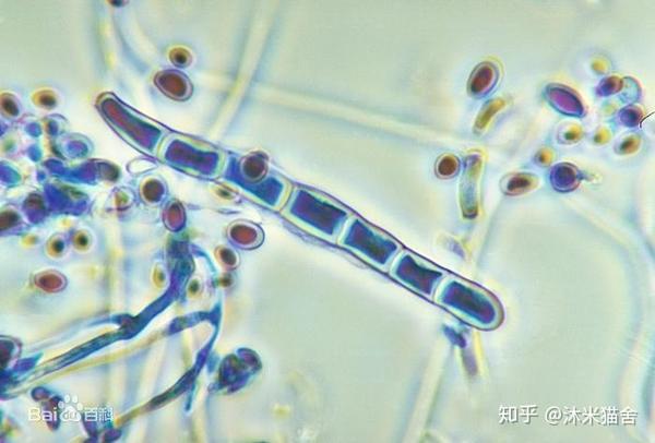 关于猫藓人类手足癣脚气的细菌真菌的一些微生物知识