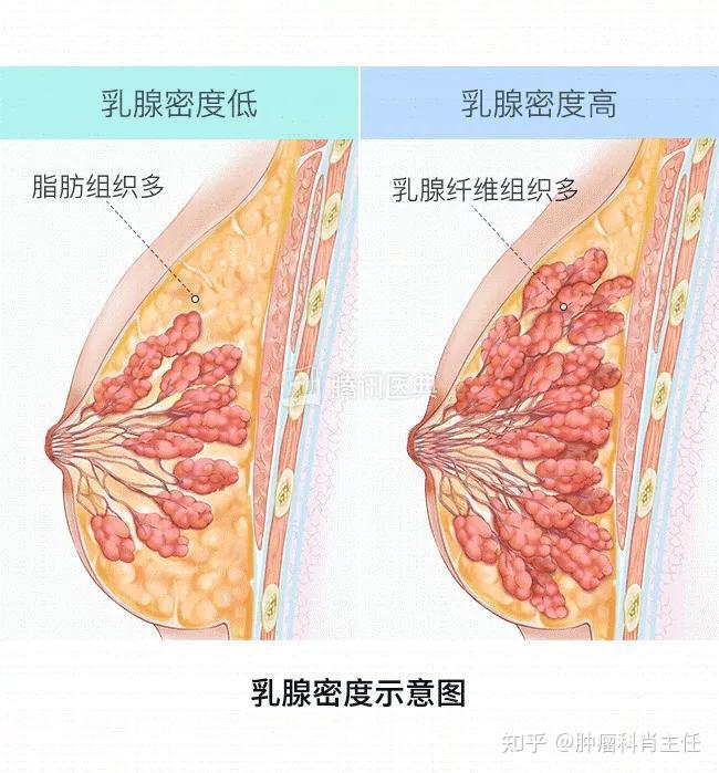决定了乳房是大是小的是胸部脂肪;乳腺则主要在"干活",负责孕期,哺乳