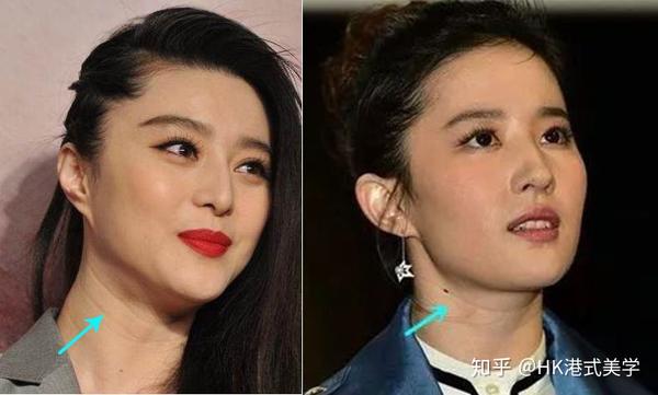 很多人的颈纹源于 天生和遗传,比如范冰冰就说过她的颈纹遗传于她父亲