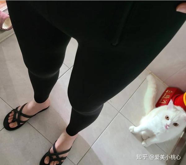 做了大腿吸脂的我,摆脱了困扰我25年的大肥腿!
