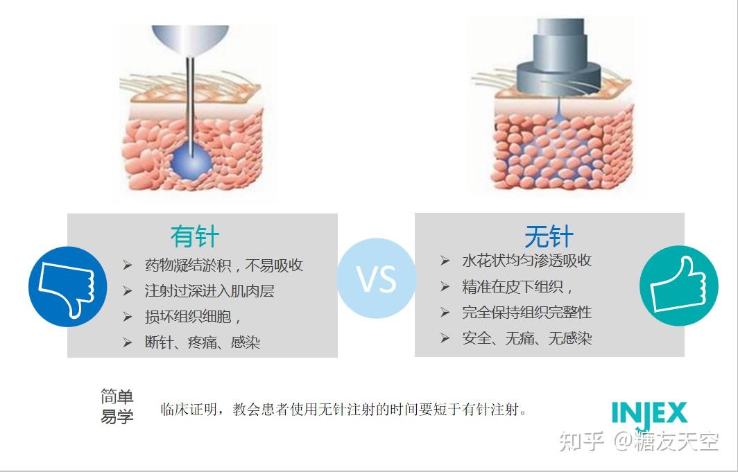 用无针注射器和用有针头的胰岛素笔注射胰岛素,这两者有什么区别呢?