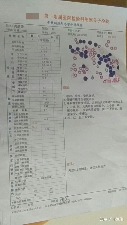 15岁小弟急性b淋巴细胞白血病治疗