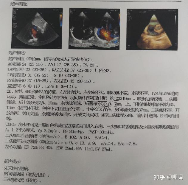11岁10个月先天性心脏病房间隔缺损修补手术记录