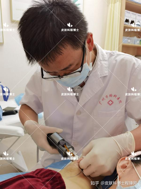 不用手术也能解决狐臭广州皮肤科医生分享