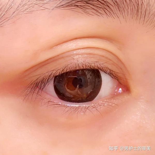三眼皮虽说比双眼皮多一层,但是显老不好看你知道如何