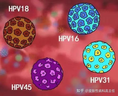 清除hpv病毒比去除疣体更重要