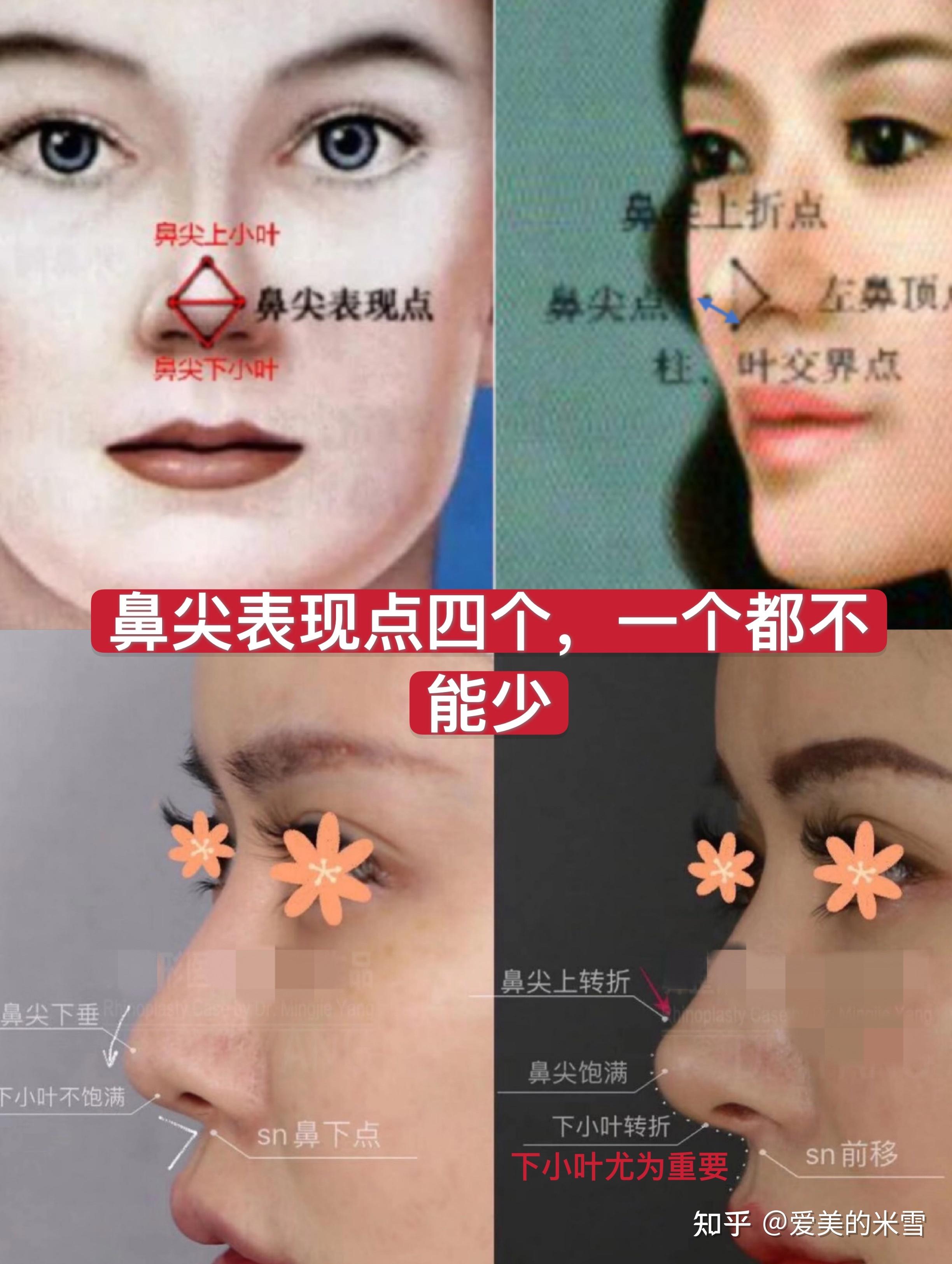 为什么do过鼻子的人大笑起来就显假