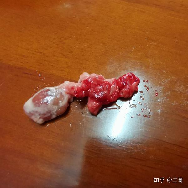 发现猪肉里有肉瘤,这个肉还能吃吗?