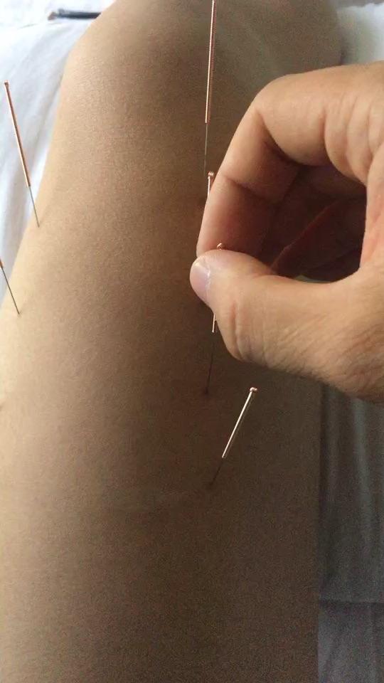 作为医护人员,有哪些让你难忘的病人或病例?