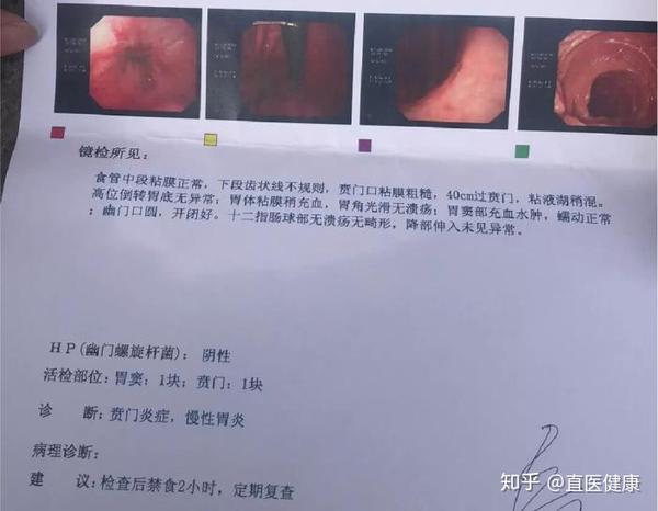 做胃镜害怕不做胃又总不适别纠结了快来看