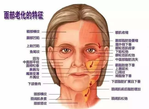 面部衰老表现有哪些30女性怎么抗衰老
