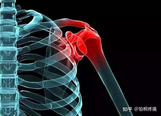 肩周炎发病率高居不下,9个拉伸动作让你远离肩痛困扰!