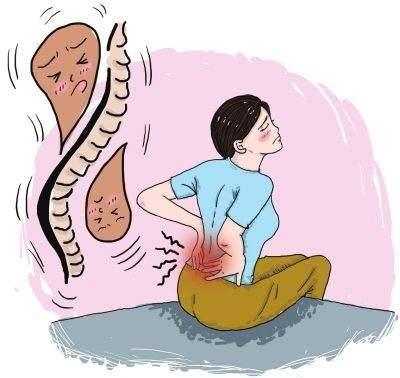 急性腰扭伤发生会出现哪些意外表现