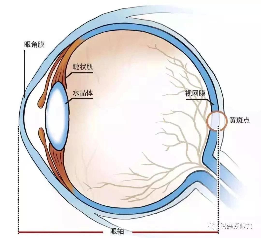 眼轴长度与近视和年龄的关系