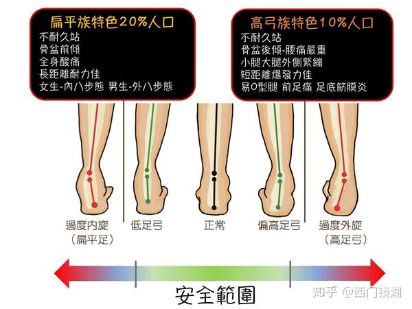 高跟鞋是产生脚踝无力的另外一个主要原因.