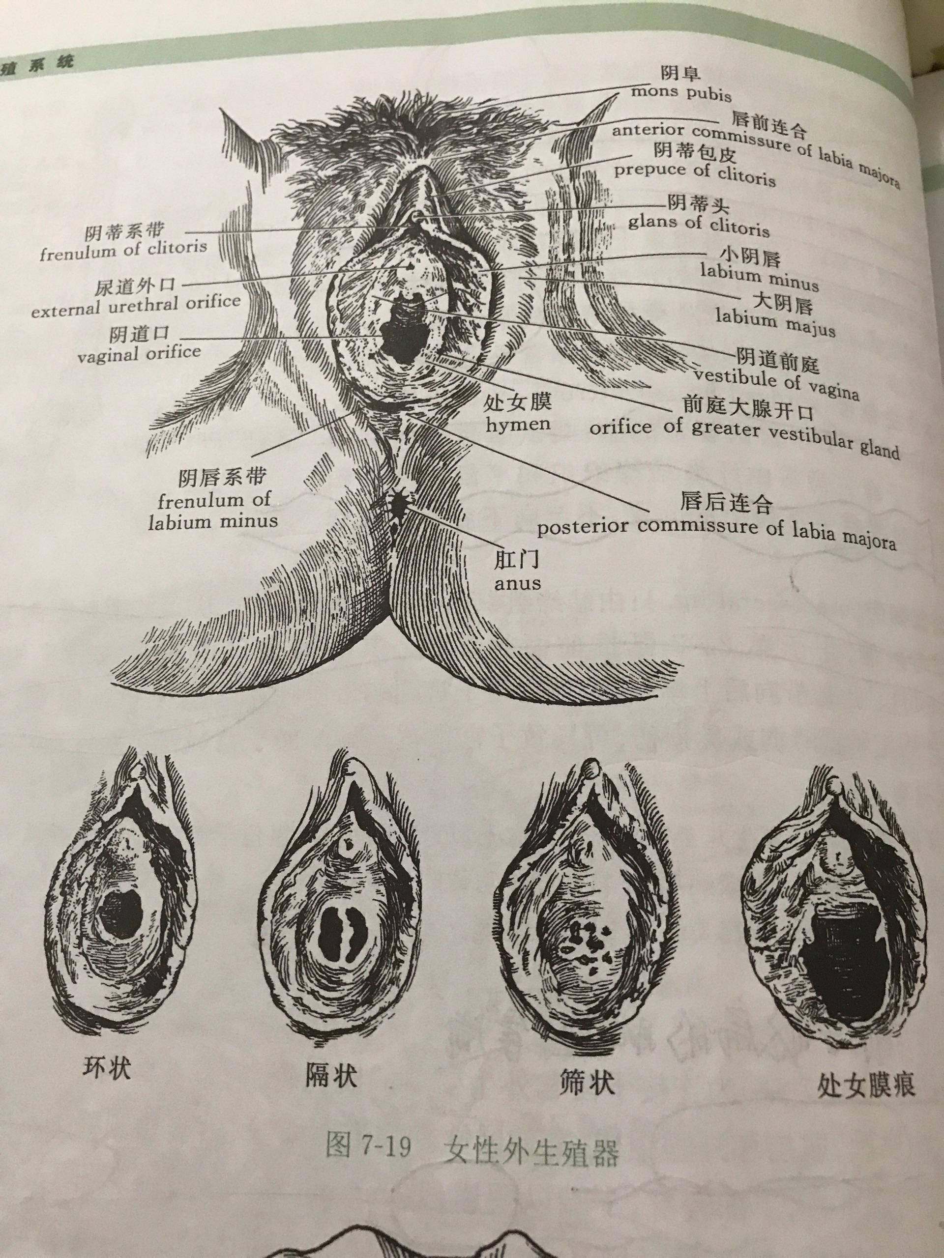 前部是尿道外口,阴道口的两侧各有一个前庭大腺导管的开口