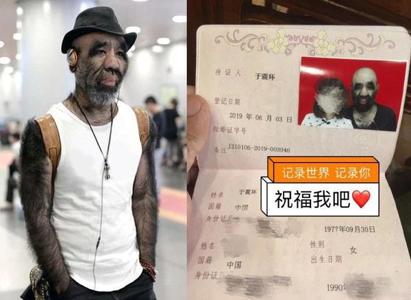 "毛哥"于震寰:全世界体毛最多的人,是如何在歧视中歌唱精彩人生