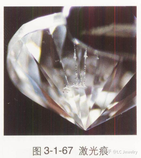 激光痕: 用激光束和化学品去除钻石内部的深色包体时留下的痕迹.
